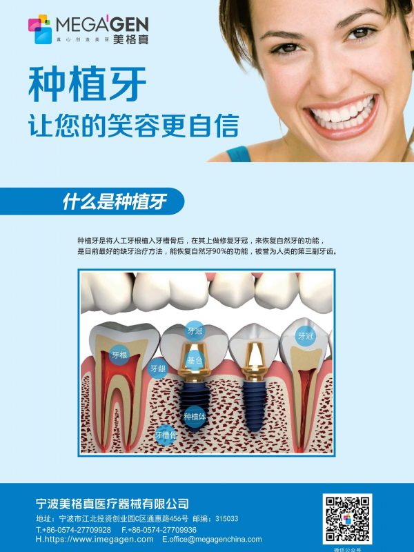 种植牙让您的笑容更自信
