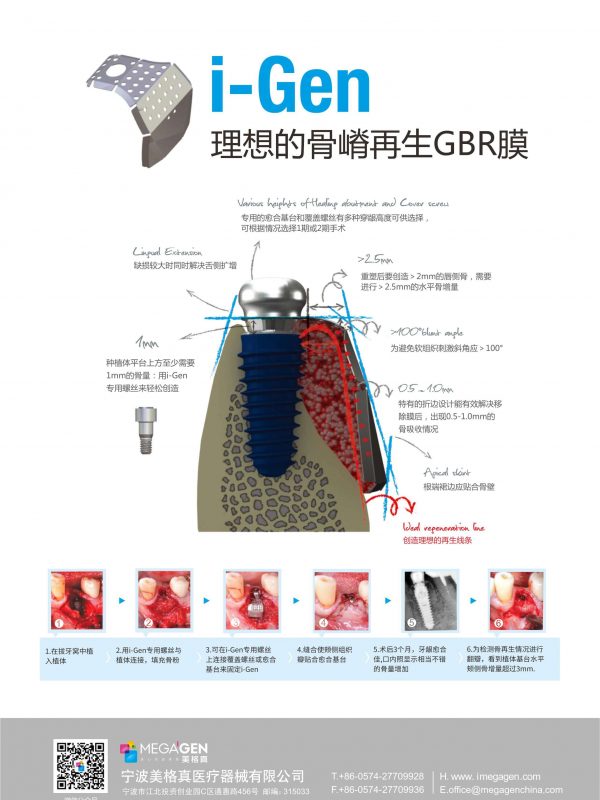 理想的骨嵴再生GBR膜