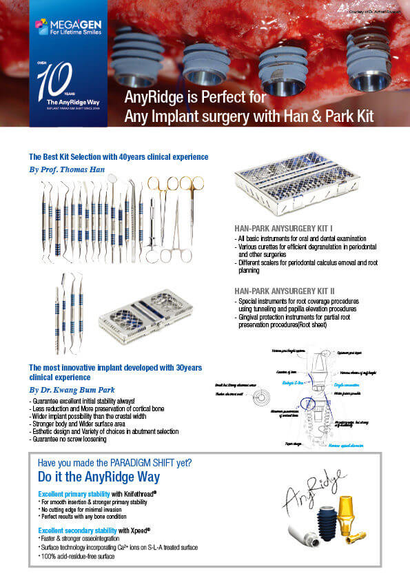 AnyRidge is Perfect for Any Implant surgery with Han&Park Kit