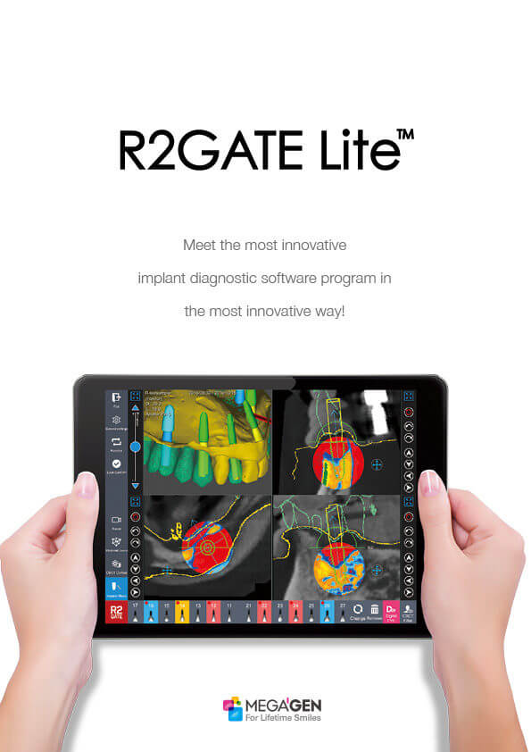 R2GATE Lite